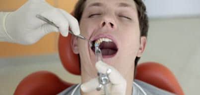 teeth | Dental Solutions Algodones