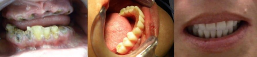 caro dyer | Los Algodones Dentists