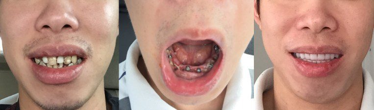 h lao | Los Algodones Dentists