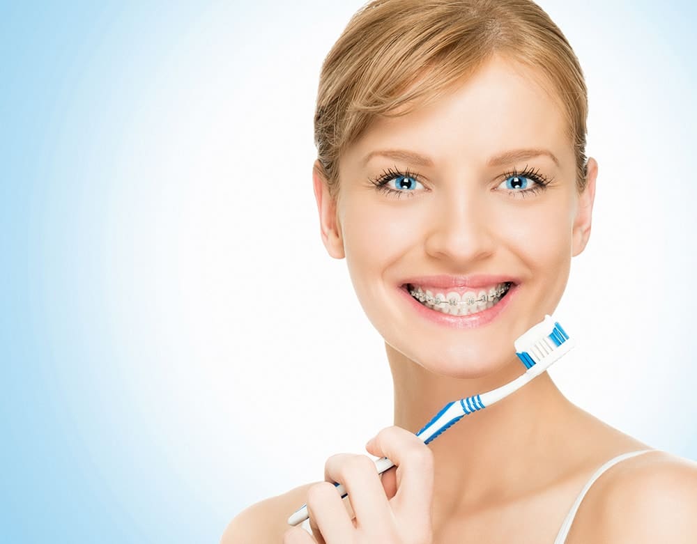 cleaning braces 2 | Dental Solutions Algodones
