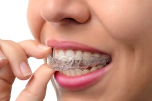 ferula bruxismo rechinar los dientes sanitum | Los Algodones Dentists