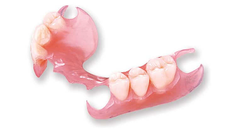 flexible partial dentures front teeth | Dental Solutions Algodones