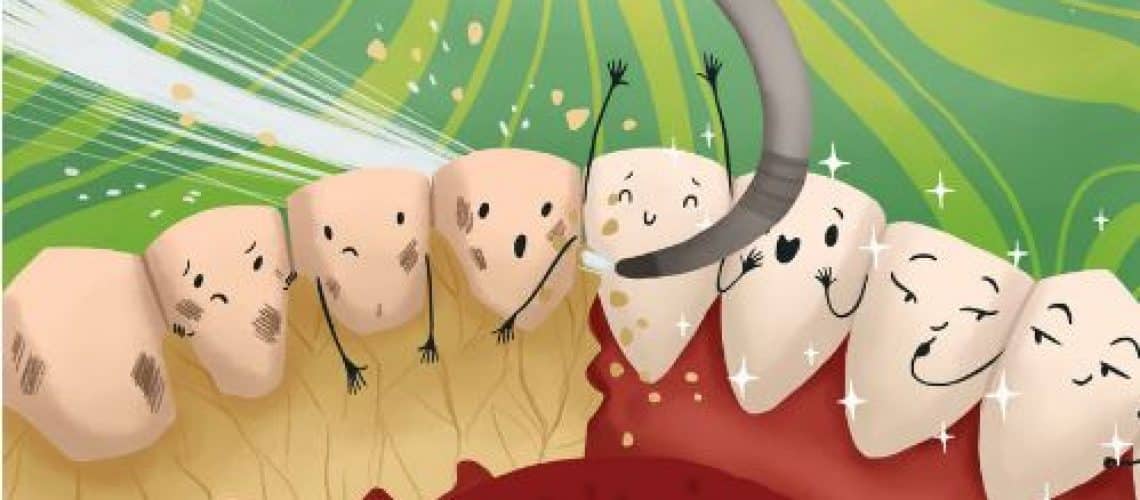 The Foleck Center Cartoon illustration of tartar | Dental Solutions Algodones