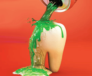 sugary drinks 2 | Los Algodones Dentists