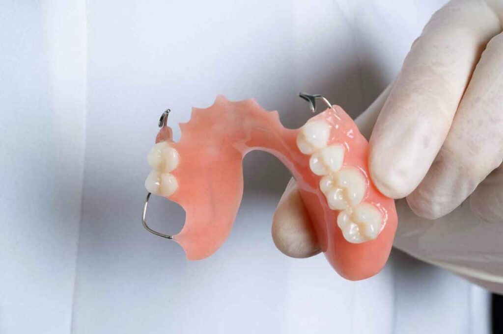 acrylic partial dentures | Los Algodones Dentists