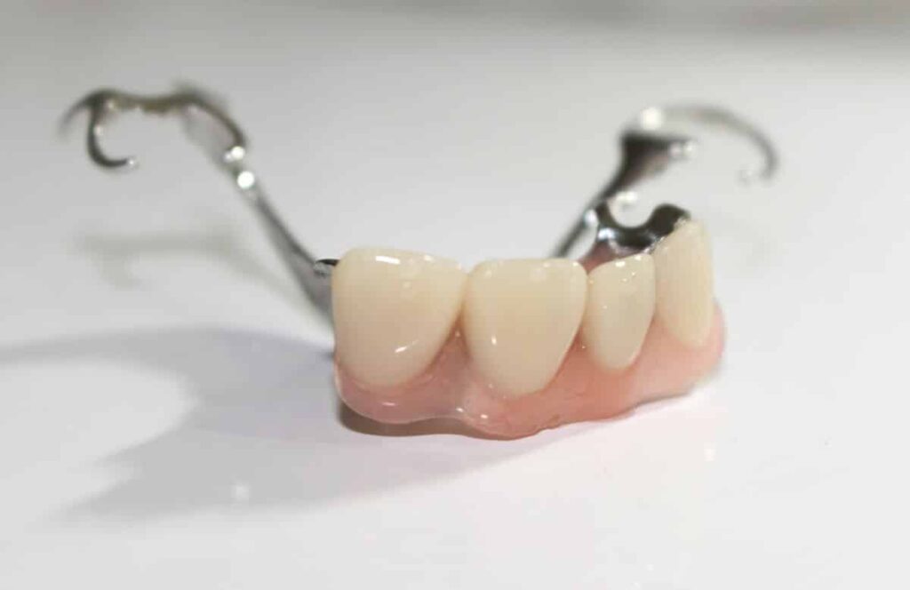 metal partial dentures | Los Algodones Dentists