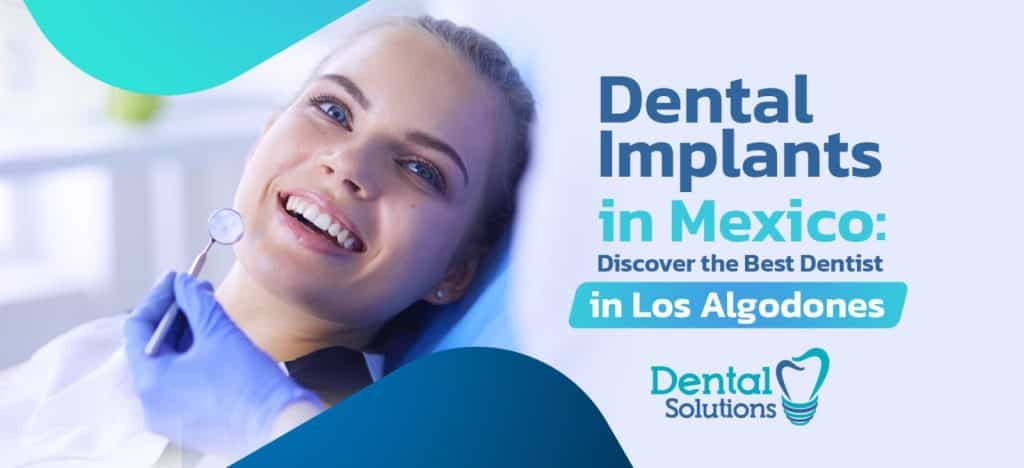 Dental implants in Los Algodones Mexico
