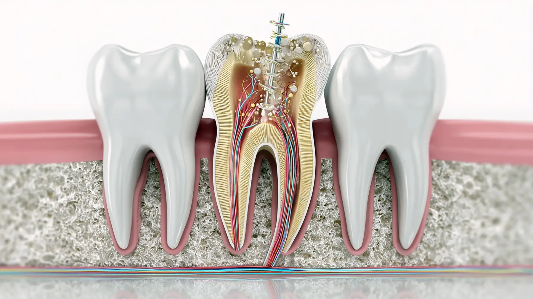 Normal Root Canal Root Canal Recovery Timeline: What’s Normal | DSA